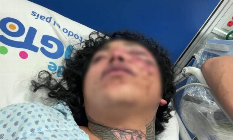 ¡Paola Suárez 'La Perdida' fue golpeada por su novio 24 hrs después de pedirle matrimonio y se encuentra hospitalizada!
