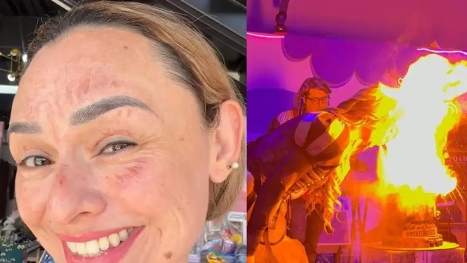 Influencer se queda sin cejas y pestañas por hacer reto viral (+video)