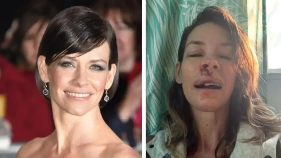 La actriz Evangeline Lilly anuncia que tiene daño cerebral